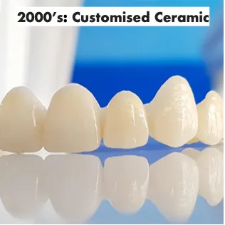 2000's: Customised Ceramic